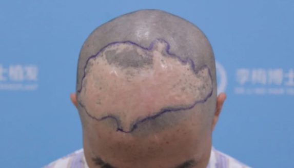 1652947351874302.png image.png